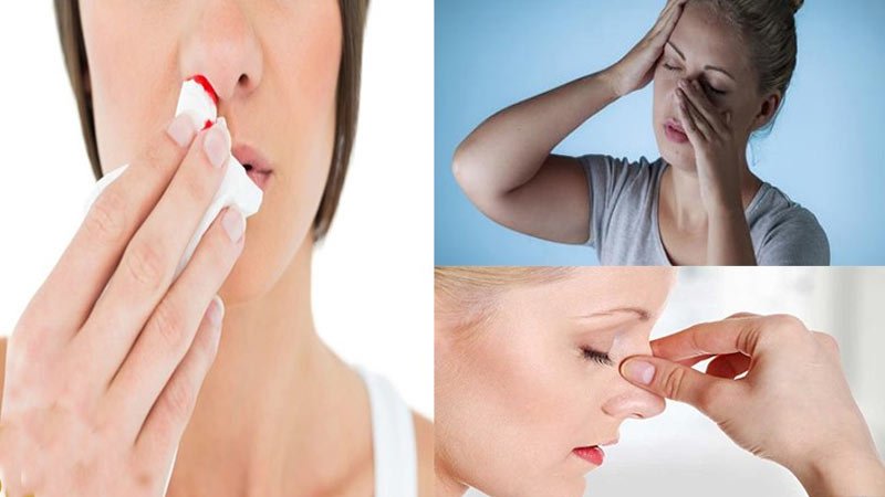 خشک شدن بینی