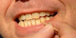 خلال دندان چیست