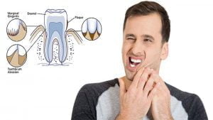 خمیر دندان ضد حساسیت