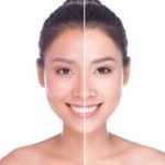 ترکیبات روشن کننده پوست برای درمان انواع لکه پوستی و هایپرپیگمانتاسیون 