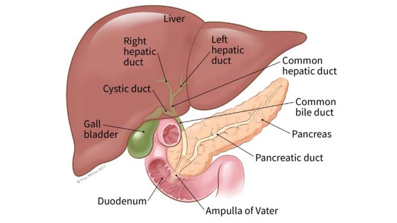 انسداد مجاری صفراوی