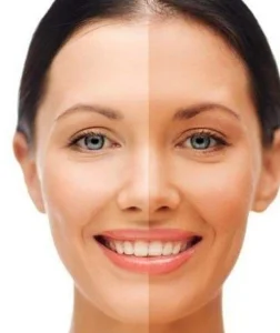 بهترین کرم روشن کننده برای پوست سبزه