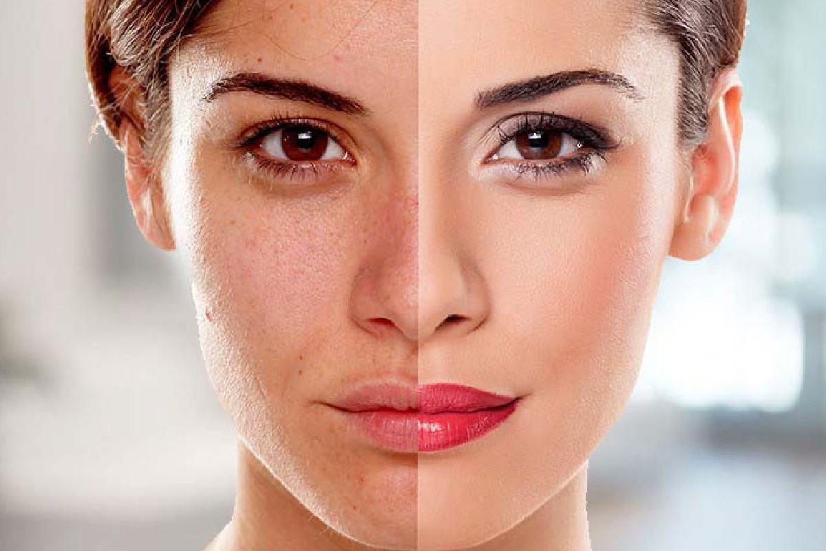 بهترین سرم روشن کننده پوست کدام است؟