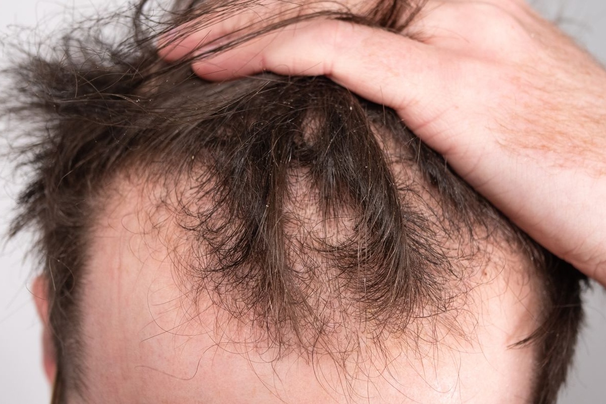 معرفی 10 تا از بهترین شامپو برای ریزش مو