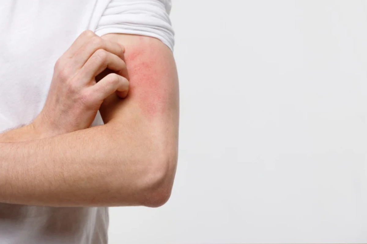 معرفی بهترین کرم ترمیم کننده برای پوست نازک