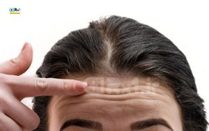 بهترین کرم ضد چروک پیشانی