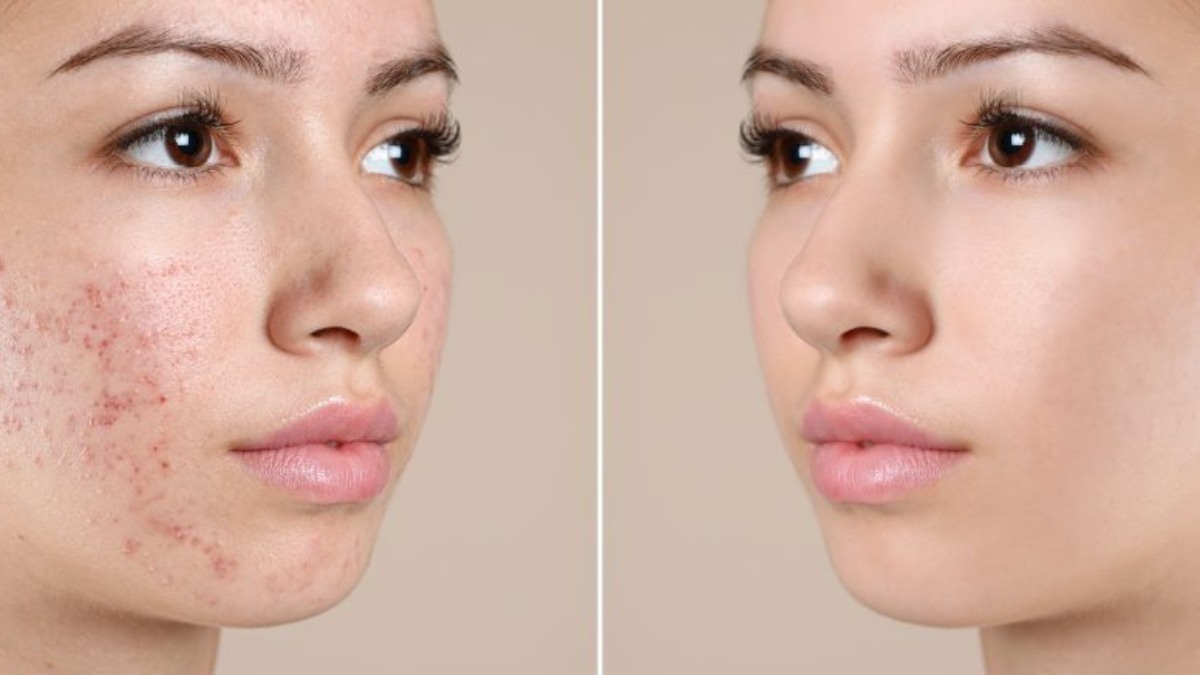 معرفی 10 مدل از بهترین لایه ‌بردار برای جای جوش‎