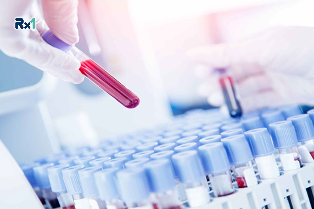 تفسیر آزمایش ویتامین دی