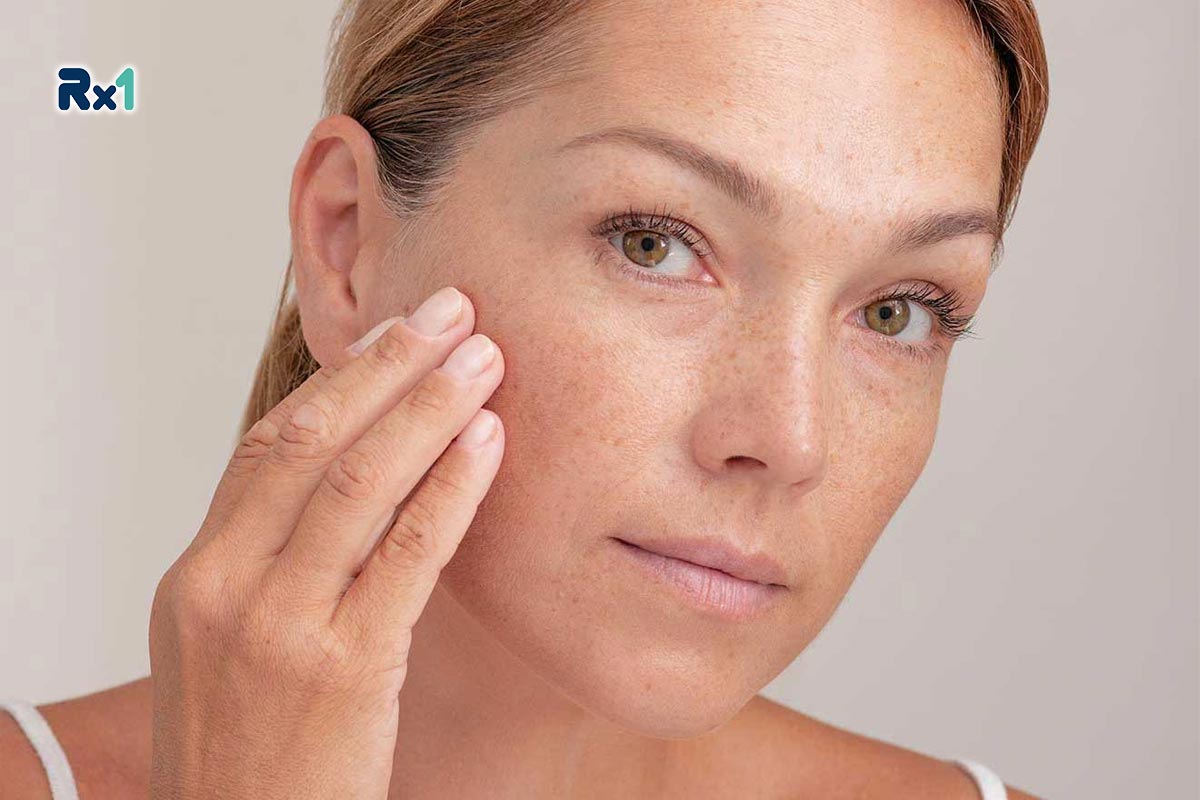 معرفی بهترین کرم برای لک قهوه‌ای صورت قوی ایرانی ‏