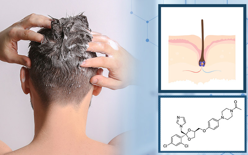 مزایای شامپو کتوکونازول چیست