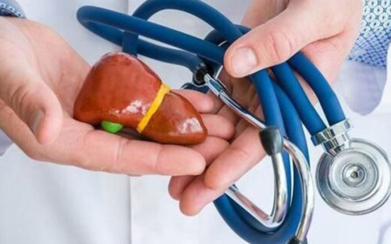 درمان کبد چرب