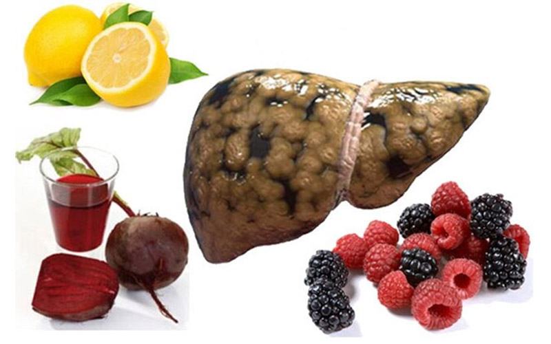 رژیم غذایی درمان کبد چرب