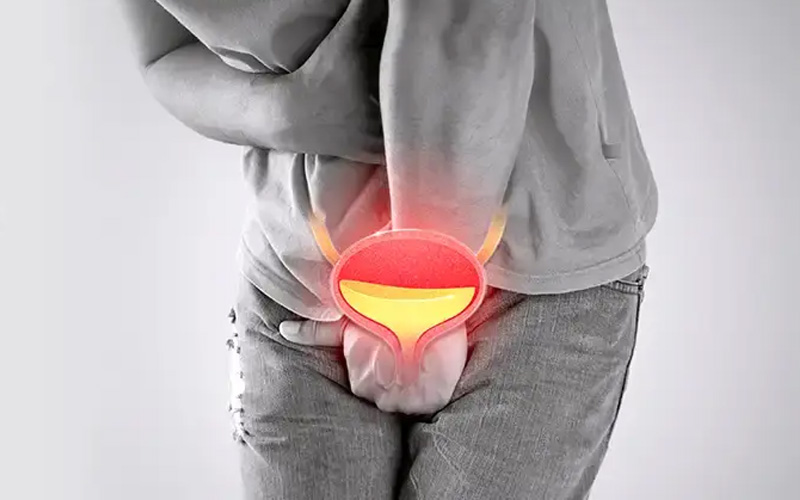 درمان سوزش ادرار چیست