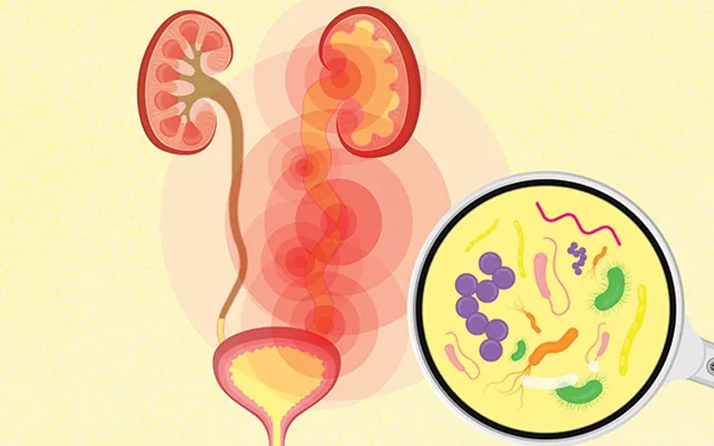 علت سوزش ادرار