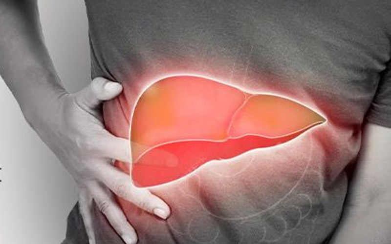 بیماری کبد چرب