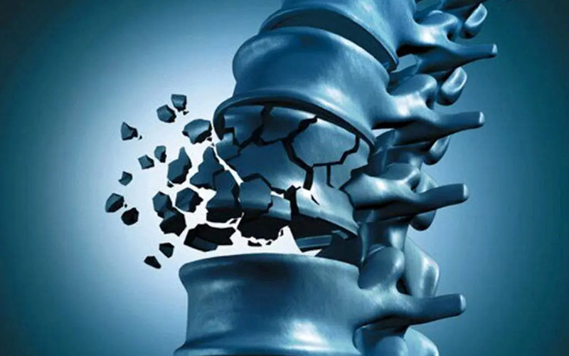 فواید منیزیم برای استخوان ها