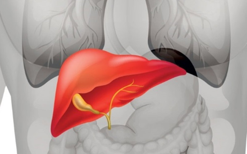 بیماری کبد چرب