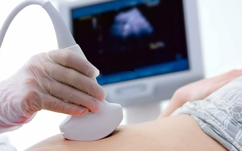 تشخیص کبد چرب