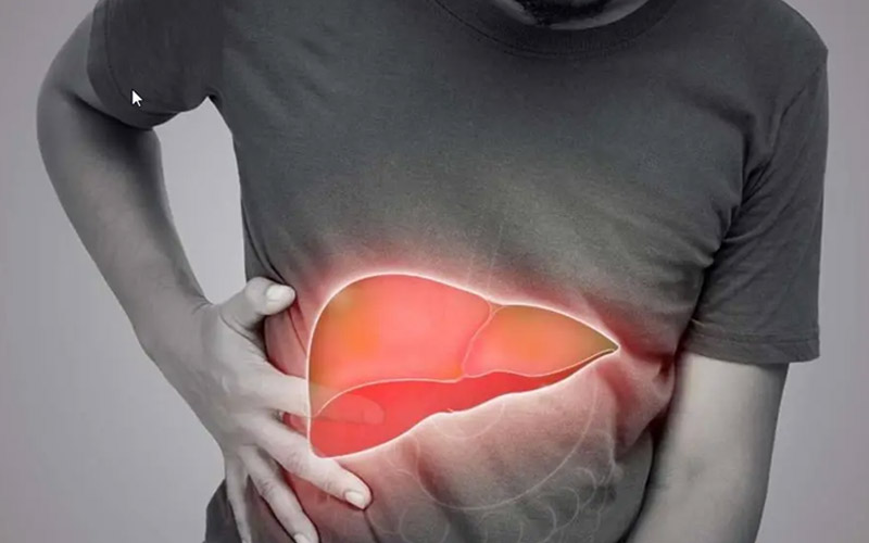 علائم کبد چرب