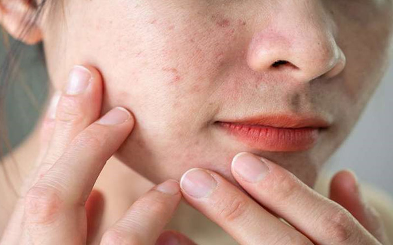 ویتامین ب2 برای پوست