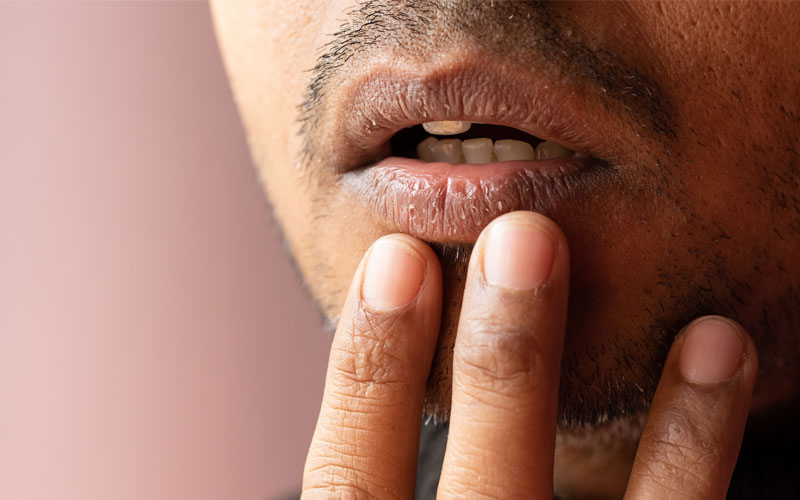 خشکی دهان چیست