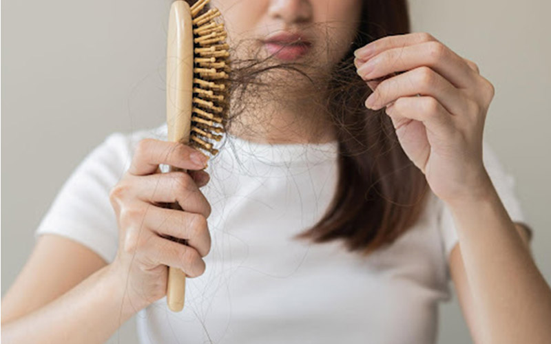 درمان ریزش مو