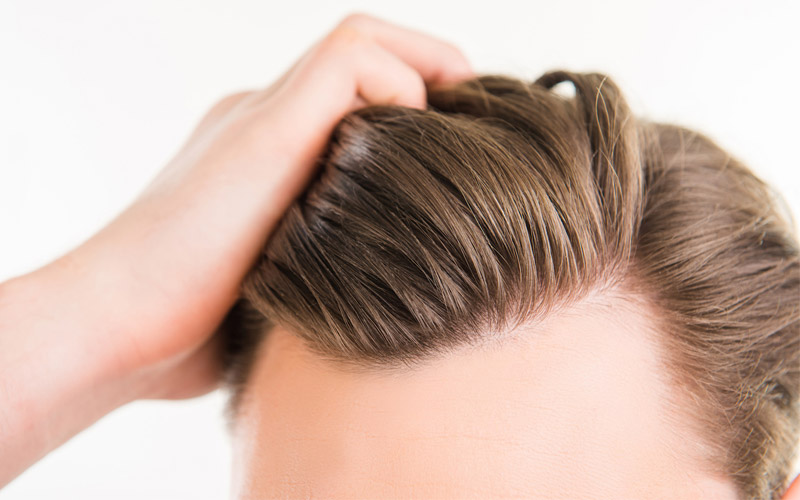 قرص هیرویت و درمان ریزش مو