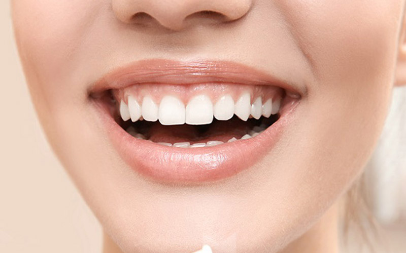 بهترین خمیر دندان سفید کننده