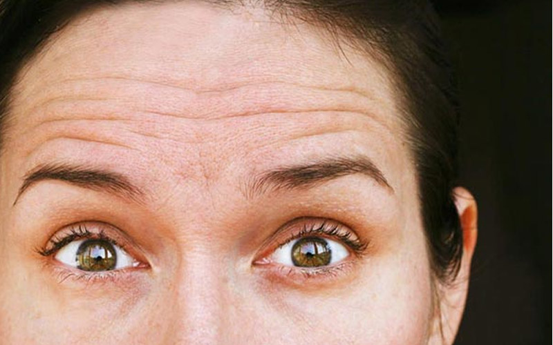بهترین کرم ضد چروک پیشانی را بشناسید؛ معرفی 10 پیشنهاد ویژه