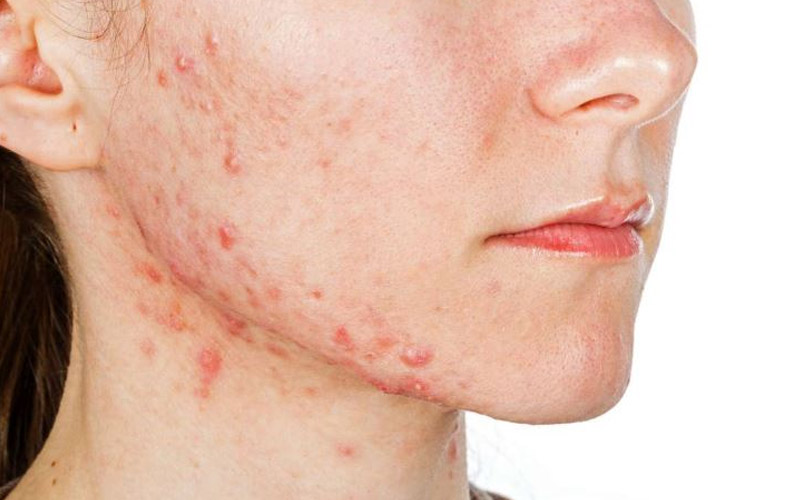 خواص اسطوخودوس برای پوست