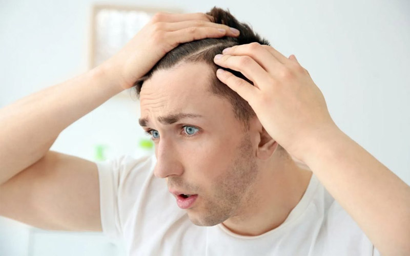 بهترین شامپو گیاهی ضد ریزش مو