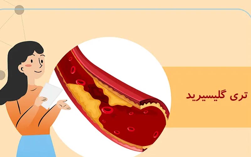 تری گلیسیرید چیست